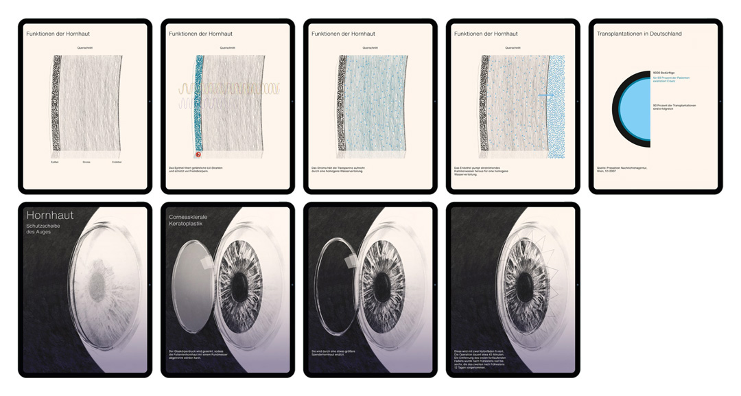 iPad screens showing transplantation of organs
