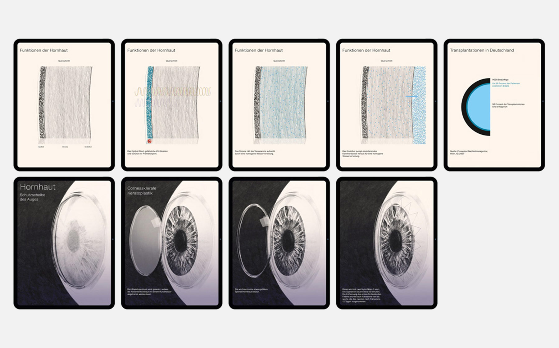 iPad screens showing transplantation of organs