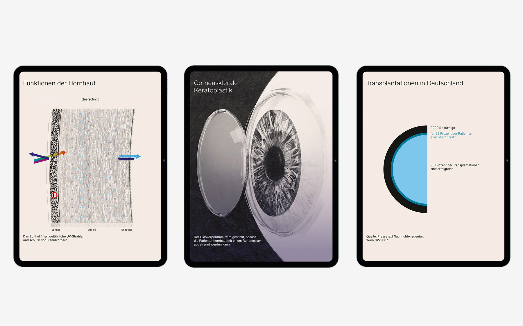 iPad screens showing transplantation of organs